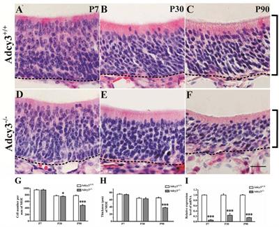 Deletion of Type 3 Adenylyl Cyclase Perturbs the Postnatal Maturation of Olfactory Sensory Neurons and Olfactory Cilium Ultrastructure in Mice